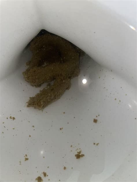 Grainy stool in adults A 42-year-old male asked What causes grainy dark stools in adults Dr. . Grainy poop reddit